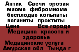 Антик.  Свечи (эрозия, миома, фибромиома, бесплодие,кольпиты, вагиниты, проктиты › Цена ­ 550 - Все города Медицина, красота и здоровье » Медицинские услуги   . Амурская обл.,Тында г.